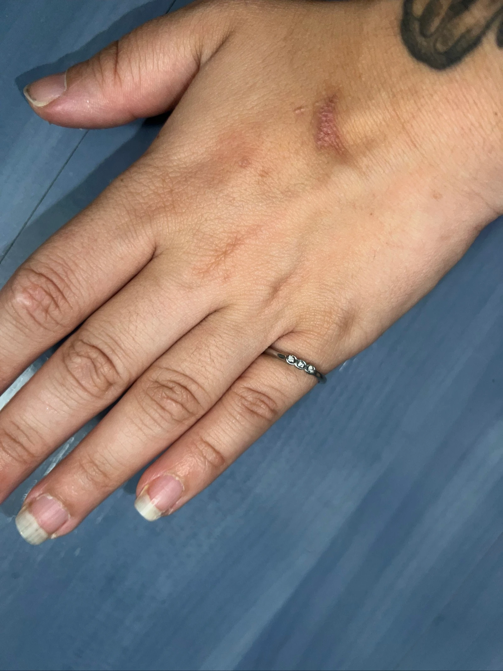 Fashion ring – photo 3